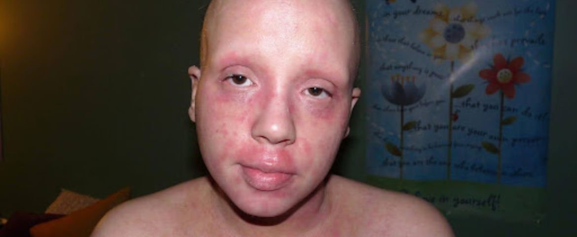 My Battle With Big Pharma